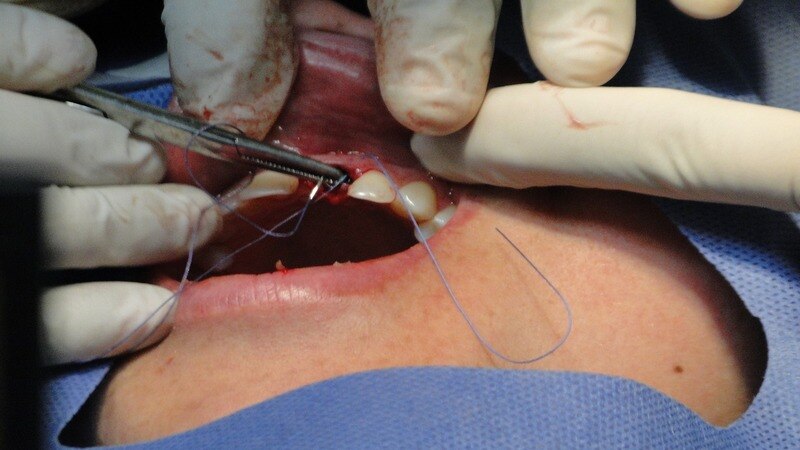surgical dentistry